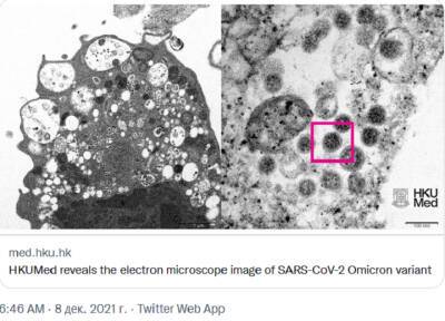 Ученые Гонконга опубликовали первый микроснимок омикрон-штамма COVID-19