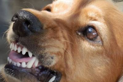 Суд в Тверской области не поверил учительнице, которую покусала собака