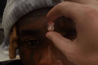 Американский рэпер имплантирует в лоб бриллиант в 11 каратов, на который он копил деньги четыре года (фото)