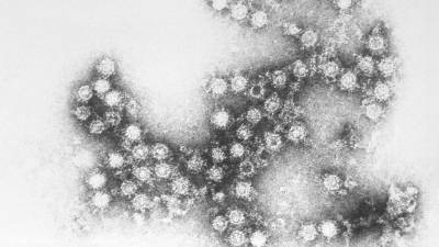Названы симптомы смешанного заболевания коронавирусом