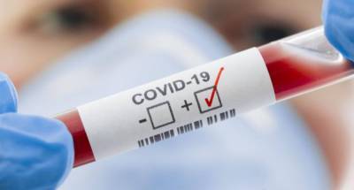 В Украине обнаружено 3409 новых случаев COVID-19: данные по регионам