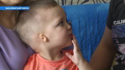 Малышу из Башкирии с одним ухом нужна помощь