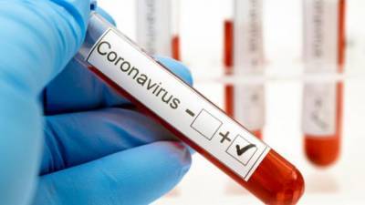 В Украине от коронавируса умерли более 24 тыс. человек, в течение суток - 5039 новых заражений