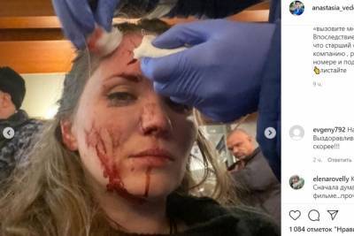 Бывшая жена актера Епифанцева показала лицо после драки в петербургском отеле
