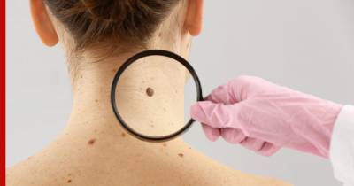 Названы симптомы редкого рака кожи, который быстро развивается без лечения