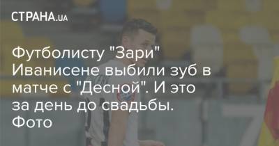 Футболисту "Зари" Иванисене выбили зуб в матче с "Десной". И это за день до свадьбы. Фото
