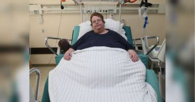 Приняли за даму: в США очень толстому мужчине по ошибке сделали кесарево сечение