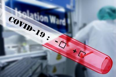 Роспотребнадзор сообщил о регистрации первого в мире теста для британского штамма COVID-19