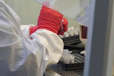 В Курганской области за сутки зарегистрировано 87 случаев коронавируса