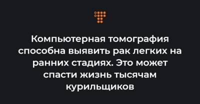 Компьютерная томография способна выявить рак легких на ранних стадиях. Это может спасти жизнь тысячам курильщиков