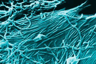 Вирусолог оценил вероятность распространения Эболы по России