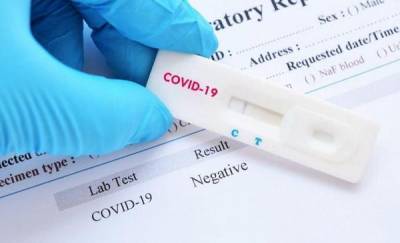 Тюменская область вошла в топ-20 по числу тестов на коронавирус