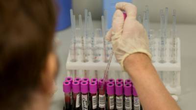 Вирусолог Викулов: России не стоит опасаться вируса Эбола