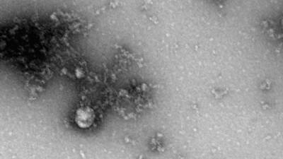 Роспотребнадзор оценил действие "ЭпиВакКороны" против штаммов коронавируса