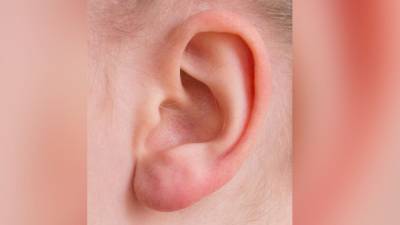 Невролог объяснил, чем опасен звон в ушах