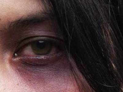 Число жертв домашнего насилия в 20 раз больше, чем заявляет МВД