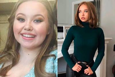 21-летняя девушка похудела на 50 килограммов и изменилась до неузнаваемости