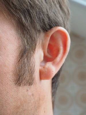 Невролог Александр Евдокимов рассказал, чем опасен звон в ушах