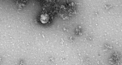 Ученые назвали реальный цвет коронавируса