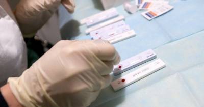 Вспышка гепатита А в детском доме Одесской области: эксперты назвали вероятную причину