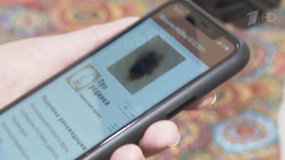 Нижегородские ученые создали мобильное приложение для определения рака кожи