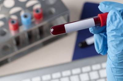 Как сдавать кровь, чтобы анализы были правдивыми – советы медика