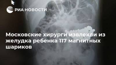 Московские хирурги извлекли из желудка ребенка 117 магнитных шариков