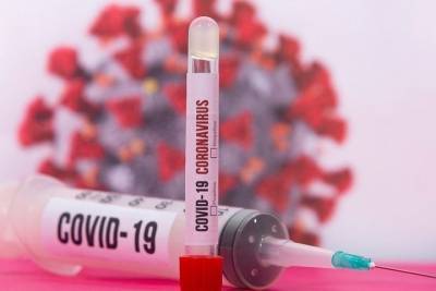 В Чувашии впервые с начала ноября выявили менее 60 заболевших COVID