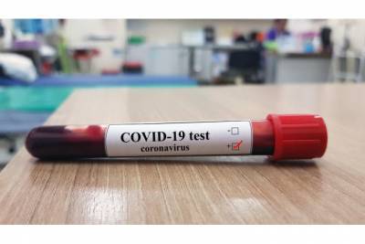 Очаг коронавирусной инфекции возник в Фленсбурге
