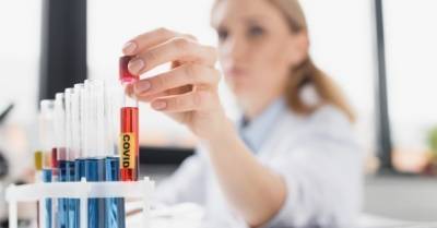 Житомирський центр крові закупив неякісні тести на антитіла до Covid-19 на 3,8 млн грн