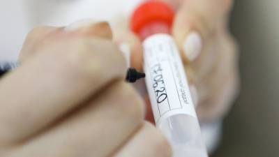 В Роскачестве дали советы по безопасной покупке тестов на антитела к COVID-19 в Сети