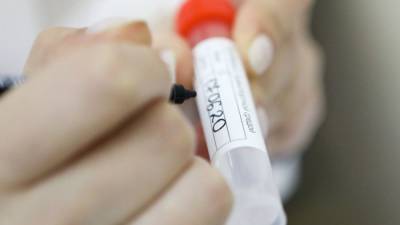 Роскачество предупреждает о мошенничестве с тестами на антитела к COVID-19