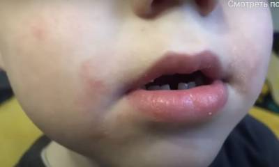 В детсаду Луцка воспитатели издеваются над детьми — им заклеивают рот и бьют