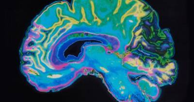 ЛСД действительно расширяет сознание, разрушая барьеры в мозге, – ученые