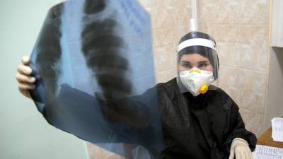 В Подмосковье врачи спасли женщину с полным поражением легких