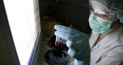На юге России у 7 сотрудников птицефабрики выявили птичий грипп