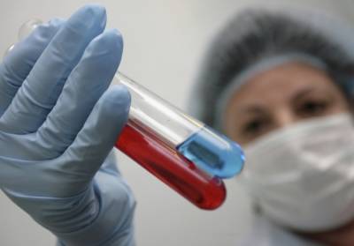 В РФ подтвержден первый в мире случай инфицирования человека вирусом птичьего гриппа