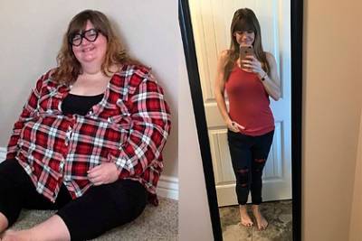 Студентка рассказала о жизни после похудения на 123 килограмма