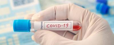 В Украине за сутки зафиксировали почти 4,5 тысячи новых случаев COVID-19