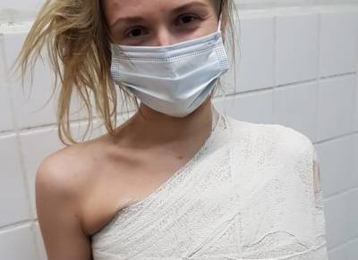 В Рязани девушка получила тяжелую травму после падения на пешеходном переходе