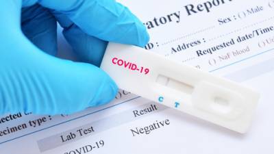 В Израиле разрешили применять домашние тесты на коронавирус