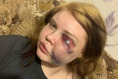 Смоляне обсуждают жестокое избиение девушки на пьяной вечеринке в Рославле