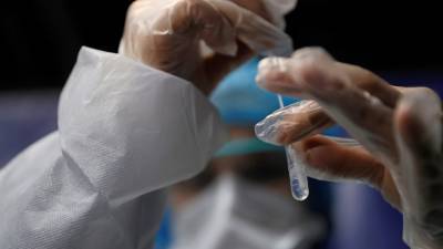 Во Франции за сутки выявили более 22 тысяч случаев коронавируса