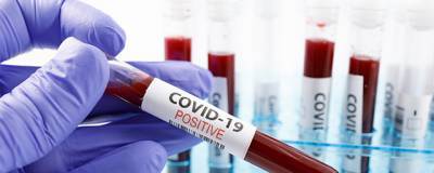 Более ста новых случаев COVID-19 выявлено за сутки в Ивановской области