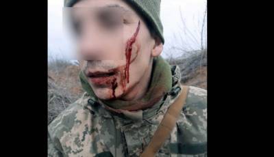 Боевик ДНР пробрался на позиции ВСУ – солдат Герман Г. обезвредил его и будет награжден – фото - ТЕЛЕГРАФ