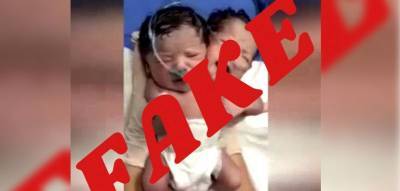 Сообщение рождении ребенка с двумя головами опроверг Минздрав Узбекистана