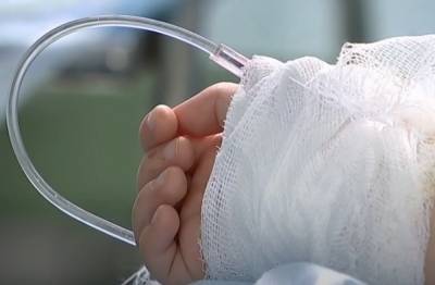 "Необходимо спасать руки": маленькая украинка пригнула в кипяток, за жизнь малышки борются врачи