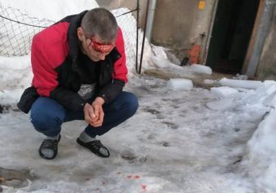 Администрация Рязани прокомментировала падение льда на голову мужчине