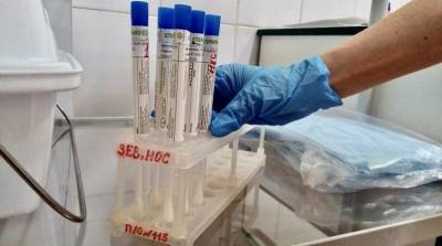 За сутки в Петербурге провели более 20 тысяч тестов на коронавирус