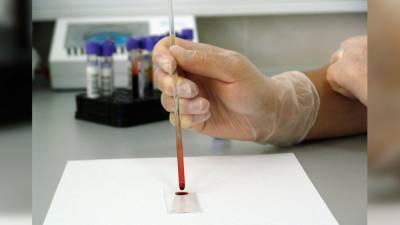 Тяжесть течения коронавируса будут предсказывать по анализу крови